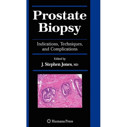 Prostate Biopsy (Hb) 