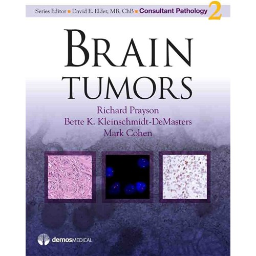 Brain Tumors Vol 2 (Hb 2010)