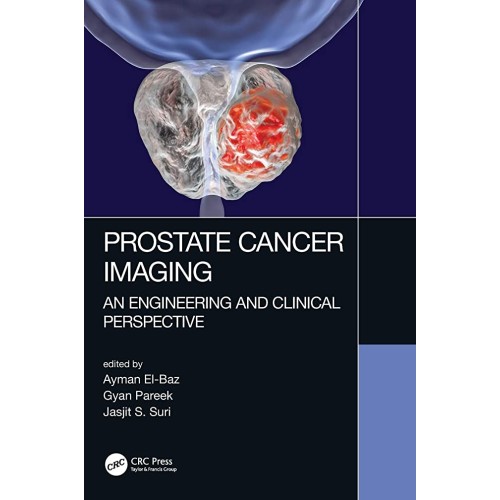 Prostate Cancer Imaging An Engineering And Cl...