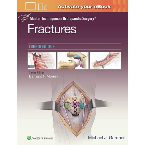 Master Techniques In Orthopaedic Surgery Frac...