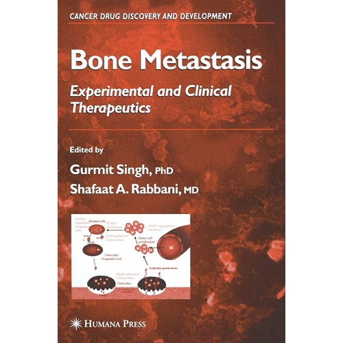 Bone Metastasis: Experimental And Clinical Th...