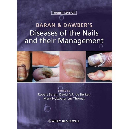 Baran And Dawbers Diseases Of The Nails And T...