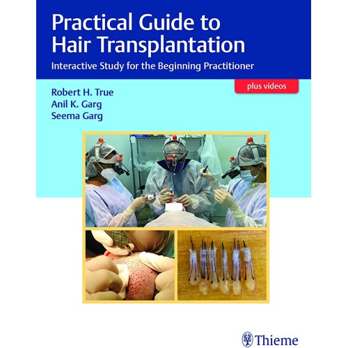 Practical Guide To Hair Transplantation Inter...