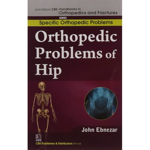 Orthopedic Problems Of Hip (Handbooks In Orth...