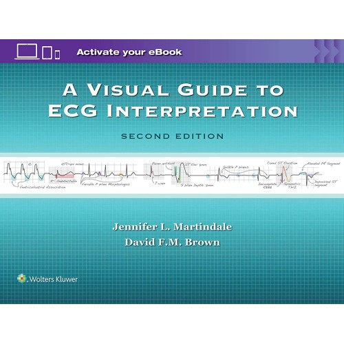 A Visual Guide To Ecg Interpretation 2Ed (Pb ...