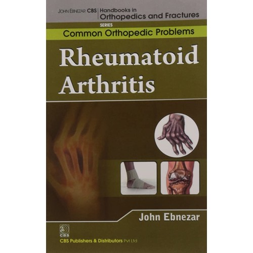 Rheumatoid Arthritis (Handbooks In Orthopedic...