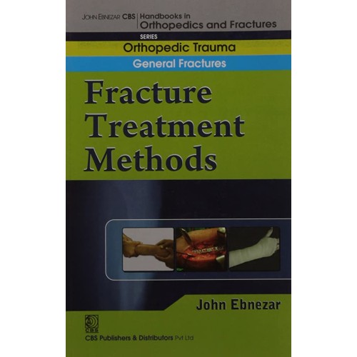 Fracture Treatment Methods (Handbook In Ortho...