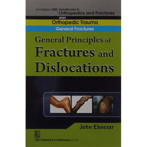 General Principles Of Fractures And Dislocati...