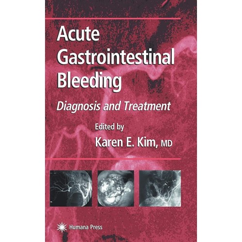 Acute Gastrointestinal Bleeding: Diagnosis An...