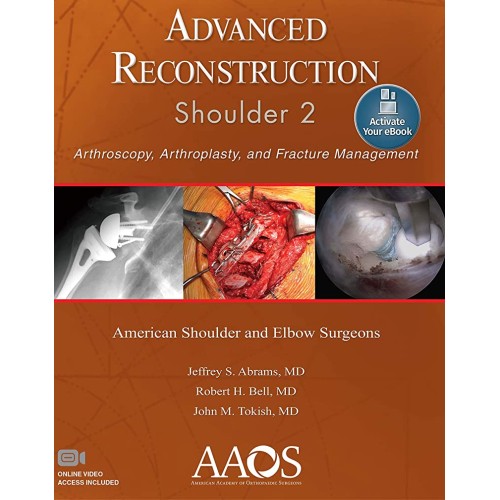 Advanced Reconstruction Shoulder 2 Arthroscop...