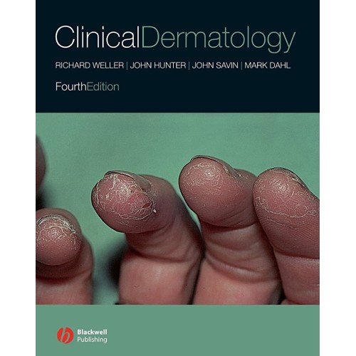 Clinical Dermatology 4E 