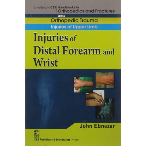 Injuries Of Distal Forearm And Wrist (Handboo...