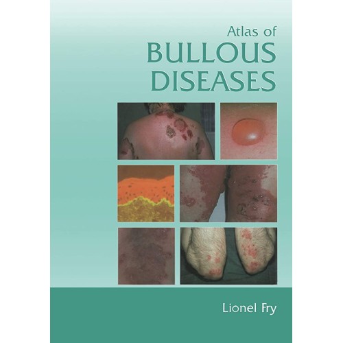 Atlas Of Bullous Diseases 