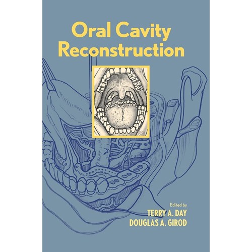 Oral Cavity Reconstruction(2006) 