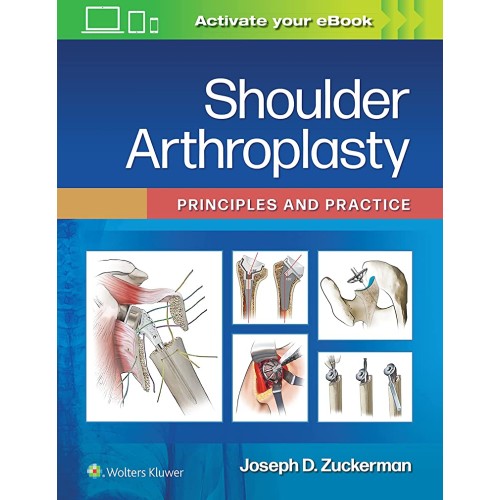 Shoulder Arthroplasty Principles And Practice...