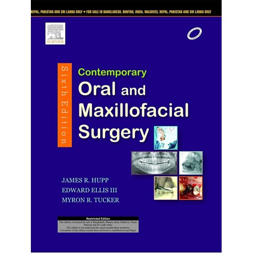 Contemporary Oral And Maxillofacial Surgery 6...