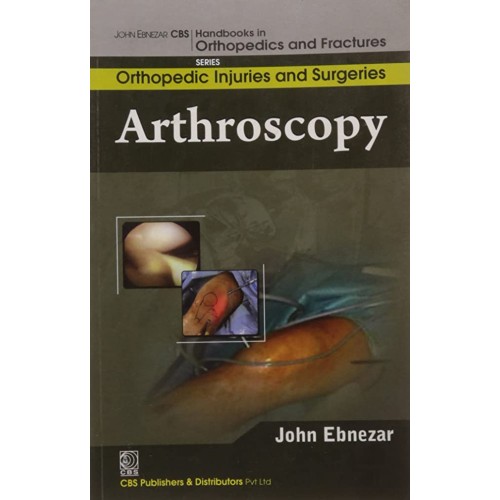 Arthroscopy (Handbooks In Orthopedics And Fra...