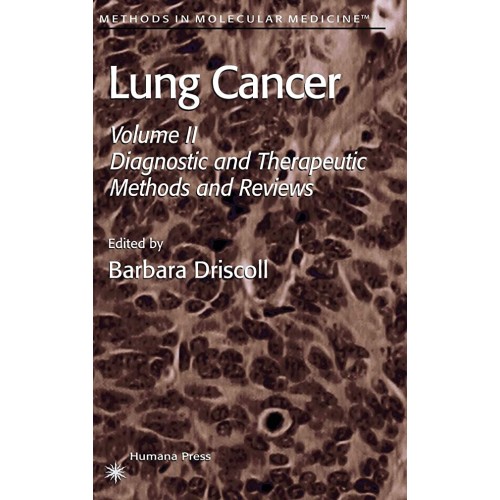 Lung Cancer: Diagnostic And Therapeutic Metho...