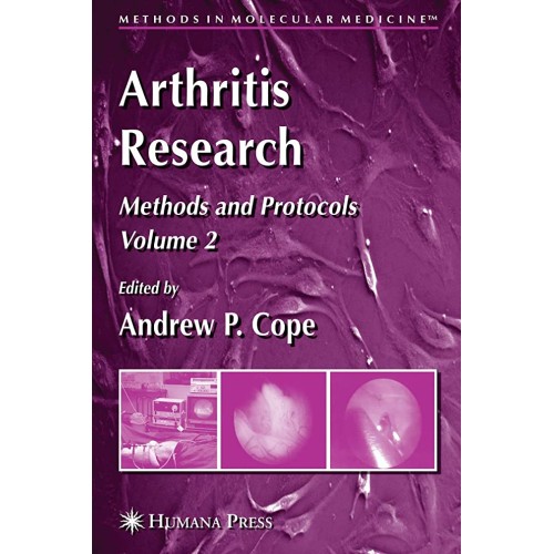 Arthritis Research: Volume 2: Methods And Pro...