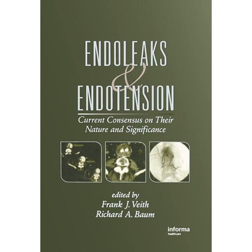 Endoleaks Endotensions (Hb 2002)