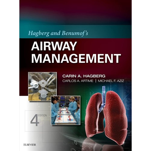 Hagberg And Benumofs Airway Management With A...