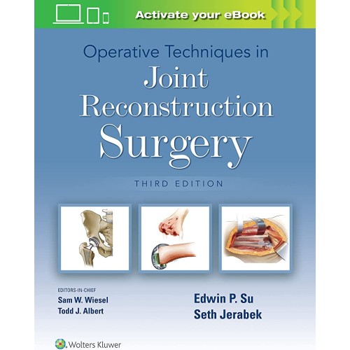 Operative Techniques In Joint Reconstruction ...