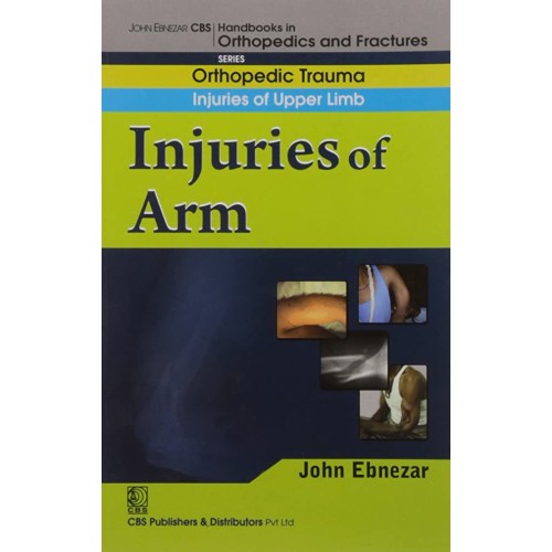 Injuries Of Arm ((Handbook In Orthopedics And...