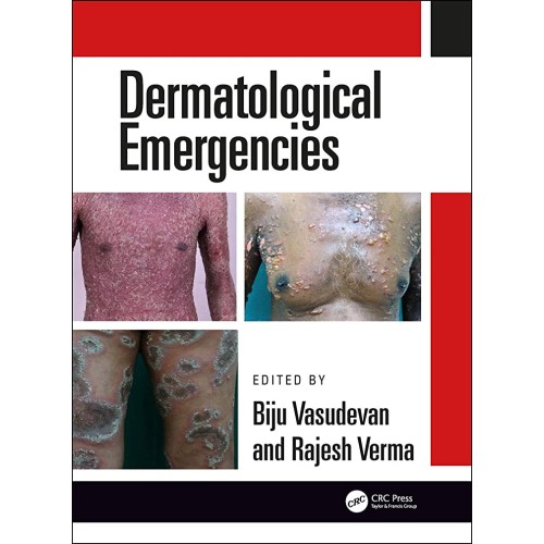 Dermatological Emergencies (Hb 2019) 