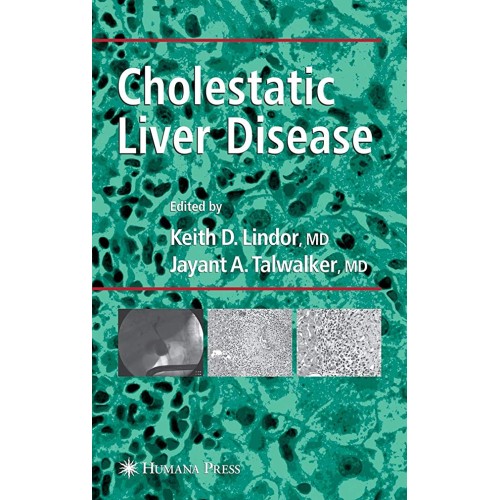 Cholestatic Liver Disease 