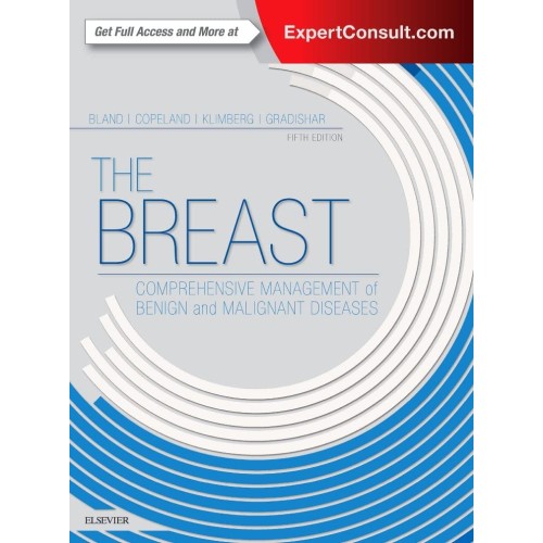 The Breast Comprehensive Management Of Benign...