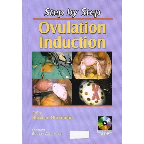 Step By Step Ovulation Induction Pb 