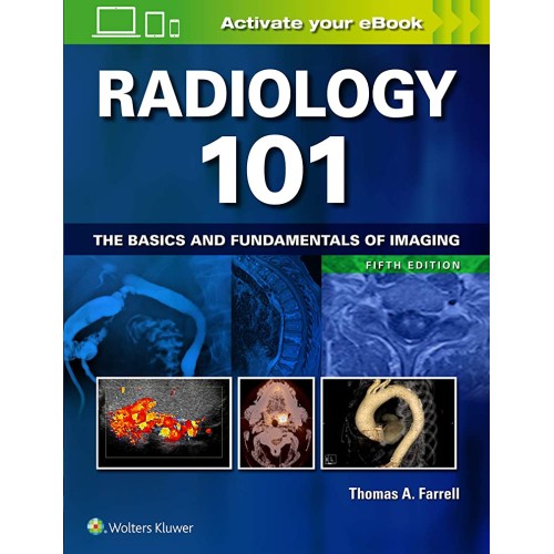 Radiology 101 The Basics And Fundamentals Of ...