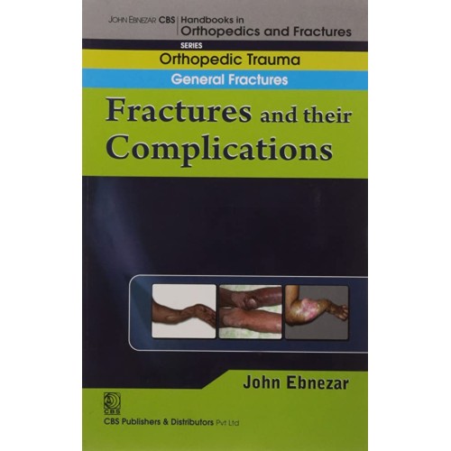 Fractures And Their Complications (Handbook I...