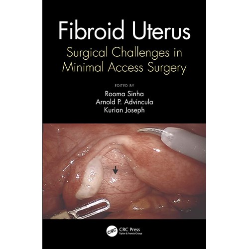 Fibroid Uterus Surgical Challenges In Minimal...