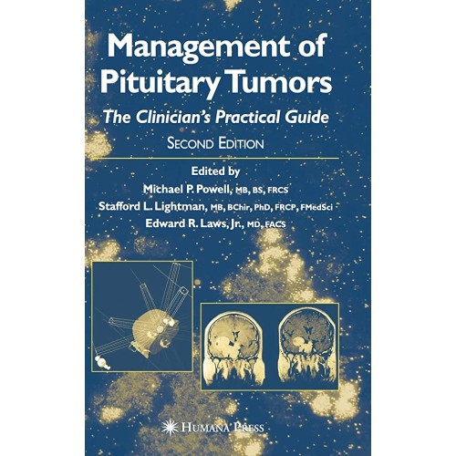 Management Of Pituitary Tumors The Clinicians...