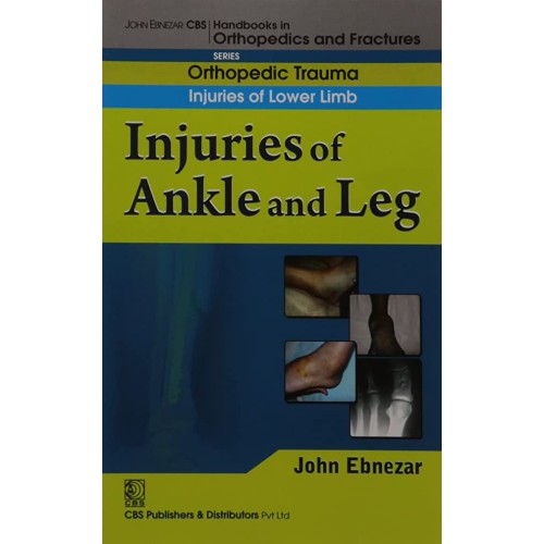 Injuries Of Ankle And Leg (Handbook Of Orthop...