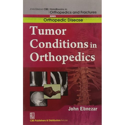 Tumor Conditions In Orthopedics (Handbooks In...