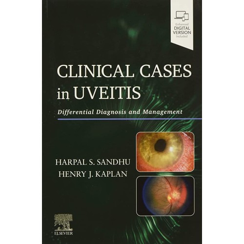 Clinical Cases In Uveitis Differential Diagno...