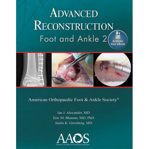 Advanced Reconstruction Foot And Ankle 2 (Pb ...