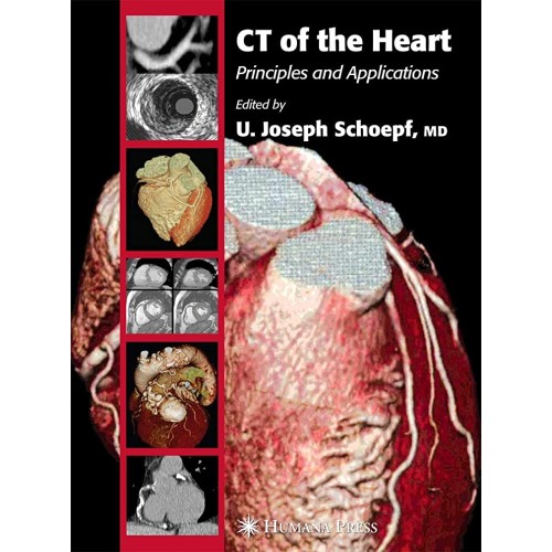 Ct Of The Heart: Principles And Applications 