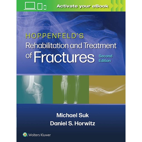 Hoppenfelds Rehabilitation And Treatment Of F...