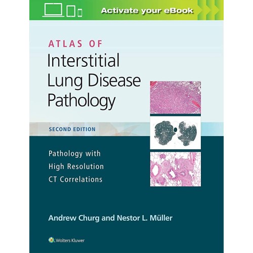 Atlas Of Interstitial Lung Disease Pathology ...