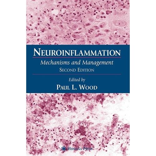 Neuroinflammation: Mechanisms And Management 