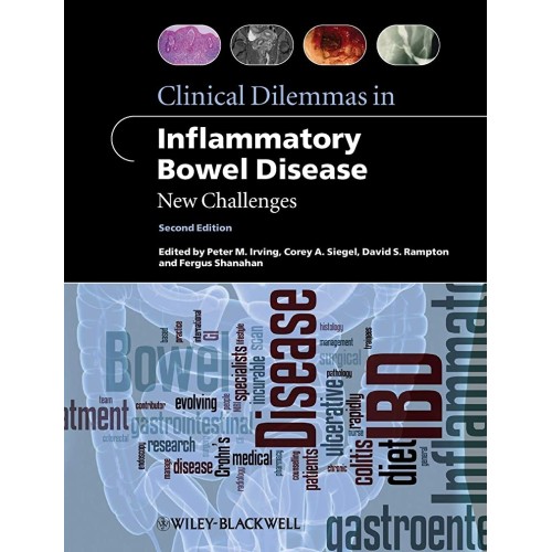 Clinical Dilemmas In Inflammatory 2Ed: New Ch...