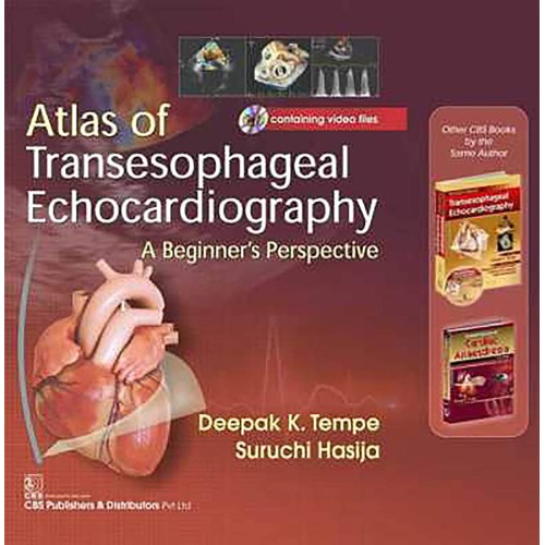 Atals Of Transesophageal Echocardiography A B...