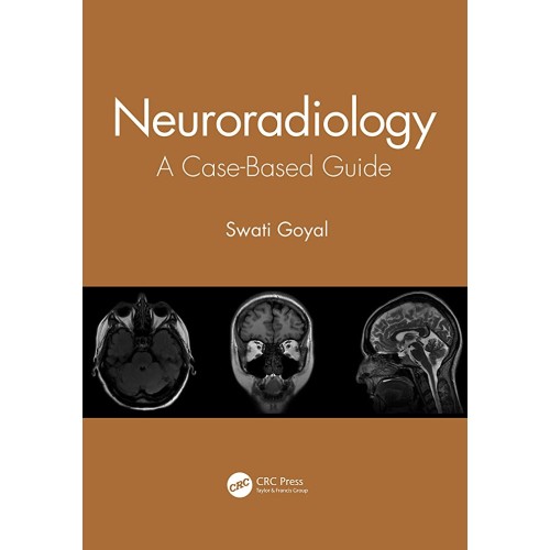 Neuroradiology A Case Based Guide (Pb 2021)