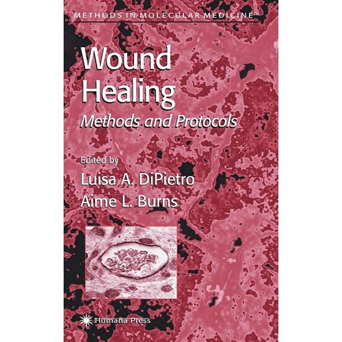 Wound Healing: Methods And Protocols (Hb) 