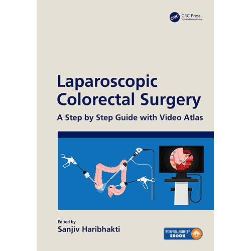 Laparoscopic Colorectal Surgery A Step By Ste...