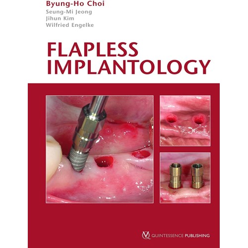 Flapless Implantology (Hb 2010) 