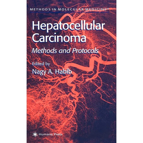 Hepatocellular Carcinoma: Methods And Protoco...